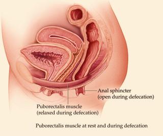 Anismus Pamela Morrison Pelvic Pain Physical Therapist P C