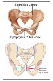 Pubic Symphysis Separation or SPD (Symphysis Pubis Dysfunction) - Pamela  Morrison Pelvic Pain Physical Therapist, P.C.