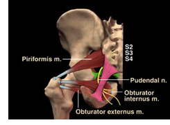 Pudendal Neuralgia