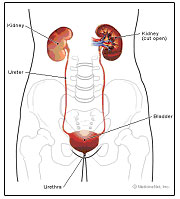 Urinary Incontinence