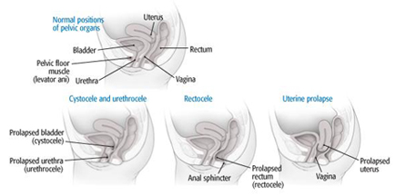 Pelvic Organ Diagram