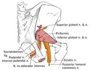 Pudendal Neuralgia Treatment & Symptoms - WHRIA