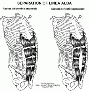 seperation of line alba