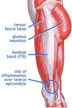 Common Marathon Injuries