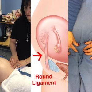 Round Ligament Pain in Pregnancy - Pamela Morrison Pelvic Pain